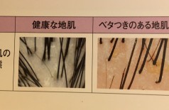 心身ともにキレイになれる！！ヘッドスパの 魅力