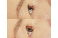 リフトアップ👁