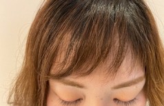 お客様のマツ育スターティン