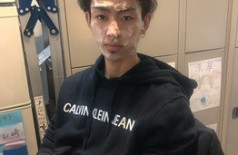 炭酸ガスパック