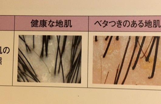 心身ともにキレイになれる！！ヘッドスパの 魅力