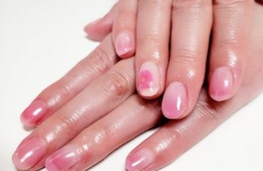 ツメコ💅