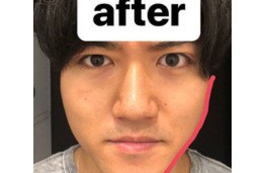 アゲアゲ最強アイテム!!