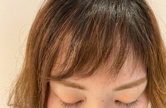 お客様のマツ育スターティン